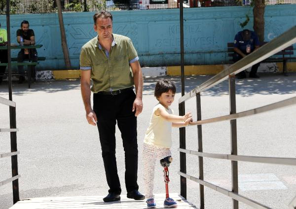 Bacağı Kesilen Minik Özge, Babasının Oyunu Sandığa Attı